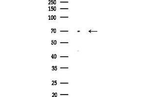 anti-Protein Phosphatase 2, Regulatory Subunit B', delta (PPP2R5D) (C-Term) antibody