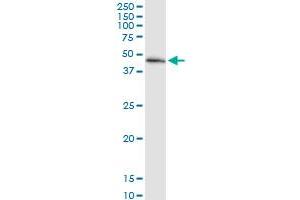 Immunoprecipitation of MECR transfected lysate using anti-MECR MaxPab rabbit polyclonal antibody and Protein A Magnetic Bead , and immunoblotted with MECR purified MaxPab mouse polyclonal antibody (B01P) . (MECR antibody  (AA 1-373))