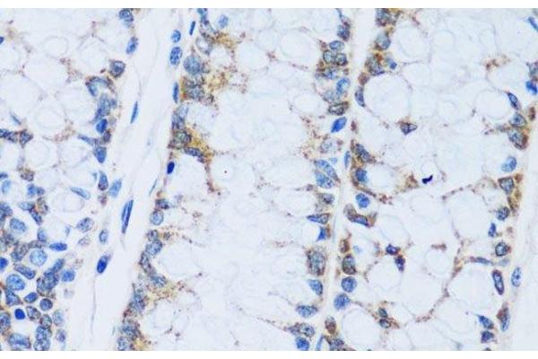 CA13 antibody