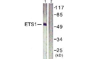 Immunohistochemistry analysis of paraffin-embedded human lung carcinoma tissue using ETS1 (Ab-38) antibody. (ETS1 antibody  (Thr38))