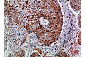 Immunohistochemistry (IHC) image for anti-Integrin alpha 1 (ITGA1) (AA 920-980) antibody (ABIN7189540)