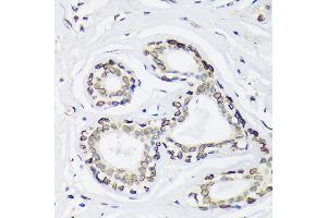 Immunohistochemistry (IHC) image for anti-Sad1 and UNC84 Domain Containing 2 (SUN2) antibody (ABIN7270136)