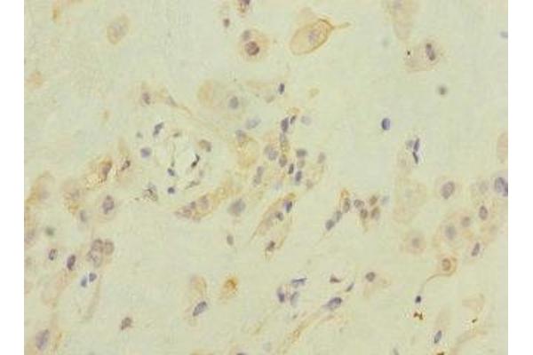 ZFPM2 anticorps  (AA 982-1151)