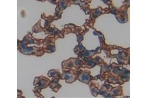 Figure. (EPHX4 antibody  (AA 36-359))