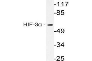 Western blot analysis of HIF3A Antibody in extracts from Rat brain cells. (HIF3A antibody)
