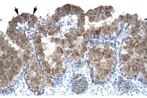 Human Intestine; ASGR2 antibody - N-terminal region in Human Intestine cells using Immunohistochemistry (Asialoglycoprotein Receptor 2 antibody  (N-Term))