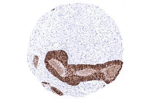 Endocervix (Recombinant Mammaglobin antibody)