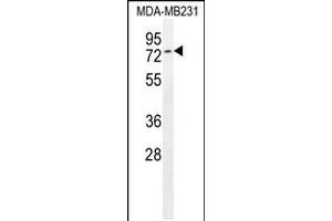 Western blot analysis in MDA-MB231 cell line lysates (35ug/lane). (Tiparp antibody  (C-Term))