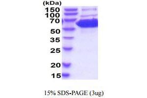 SDS-PAGE (SDS) image for Pyruvate Kinase M1/2 (PKM) (AA 1-531) (Active) protein (His tag) (ABIN6388051)