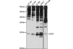 Western blot analysis of extracts of various cell lines, using SNRNP25 antibody (ABIN7270360) at 1:1000 dilution. (SNRNP25 antibody  (AA 1-132))