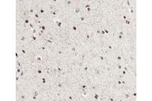 ABIN6267035 at 1/100 staining human Brain tissue sections by IHC-P. (CBP antibody  (C-Term))
