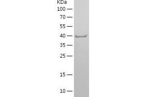 Western Blotting (WB) image for Myoglobin (MB) (AA 2-154) protein (His-IF2DI Tag) (ABIN7282776) (Myoglobin Protein (MB) (AA 2-154) (His-IF2DI Tag))