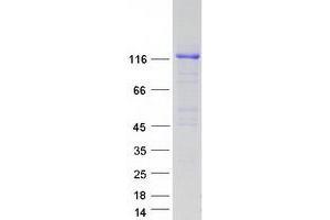 Validation with Western Blot