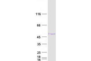 Western Blotting (WB) image for GATA Binding Protein 3 (GATA3) (Transcript Variant 2) (Active) protein (Myc-DYKDDDDK Tag) (ABIN2721729)