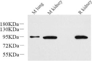 Western Blot analysis of various samples using Catenin beta Monoclonal Antibody at dilution of 1:1000. (beta Catenin antibody)