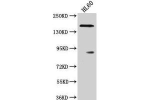 Western Blot Positive WB detected in: HL60 whole cell lysate All lanes: ROCK1 antibody at 1:2000 Secondary Goat polyclonal to rabbit IgG at 1/50000 dilution Predicted band size: 159 kDa Observed band size: 159 kDa (ROCK1 antibody  (AA 405-668))