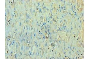 Immunohistochemistry of paraffin-embedded human epityphlon tissue using ABIN7166926 at dilution of 1:100 (TP53I3 antibody  (AA 163-332))