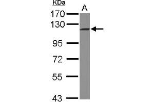Western Blotting (WB) image for anti-Integrator Complex Subunit 5 (INTS5) (C-Term) antibody (ABIN1491787) (INTS5 antibody  (C-Term))