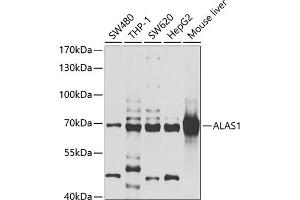Western blot analysis of extracts of various cell lines, using  antibody (ABIN6129895, ABIN6136754, ABIN6136756 and ABIN6222177) at 1:1000 dilution. (ALAS1 antibody  (AA 1-250))