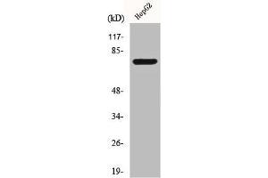 Western Blot analysis of Jurkat cells using CLIP4 Polyclonal Antibody (CLIP4 antibody  (Internal Region))