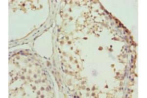 Immunohistochemistry of paraffin-embedded human testis tissue using ABIN7176109 at dilution of 1:100 (ZNF131 antibody  (AA 80-379))