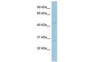Image no. 1 for anti-Melanoma Antigen Family A, 10 (MAGEA10) (AA 251-300) antibody (ABIN6741654) (MAGEA10 antibody  (AA 251-300))