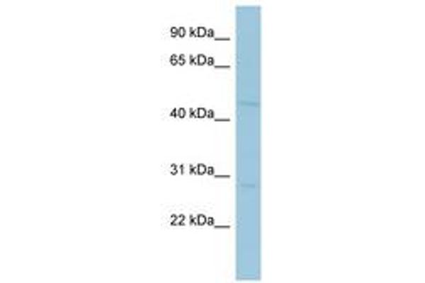 MAGEA10 antibody  (AA 251-300)