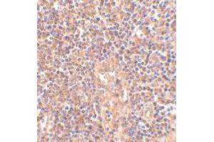 Immunohistochemistry of ATM in human lymph node tissue with ATM polyclonal antibody  at 2. (ATM antibody  (C-Term))