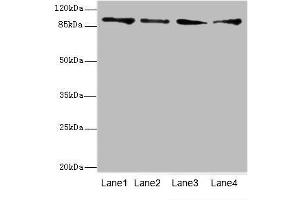 Western blot analysis of (1) HeLa whole cell lysate, (2) Mouse heart tissue, (3) HepG-2 whole cell lysate and (4) Jurkat whole cell lysate, using TNNI3K antibody (4. (TNNI3K antibody  (AA 1-75))