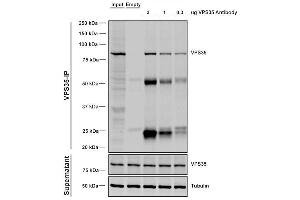 Immunoprecipitation analysis using Mouse Anti-VPS35 Monoclonal Antibody, Clone 5A9 (ABIN6932954). (VPS35 antibody  (PE))