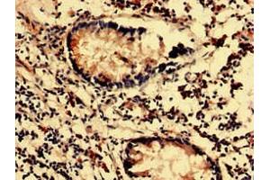 Immunohistochemistry analysis of human appendix tissue using ABIN7143903 at dilution of 1:100