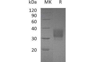 Fc Fragment of IgG, Low Affinity IIb, Receptor (CD32) (FCGR2B) protein (His tag)