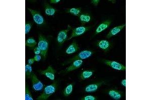 Immunofluorescence (IF) image for anti-Tumor Protein P53 (TP53) antibody (ABIN7305220)