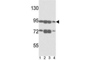 Western blot analysis of ABCB5 antibody and 1) A375, 2) K562, 3) A2058 and4)  HL-60 lysate. (ABCB5 antibody  (AA 1-30))