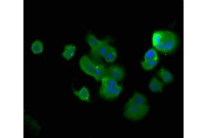 Immunofluorescence staining of MCF-7 cells with ABIN7173373 at 1:400, counter-stained with DAPI. (TCHP antibody  (AA 1-498))