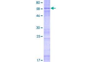 PTPLAD1 Protein (AA 1-362) (GST tag)