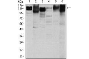 Western Blotting (WB) image for anti-Integrin beta 1 (ITGB1) antibody (ABIN1106231) (ITGB1 antibody)