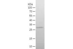 ETS2 Protein (AA 226-469) (His tag)