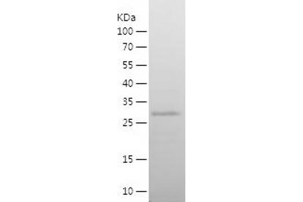 ETS2 Protein (AA 226-469) (His tag)