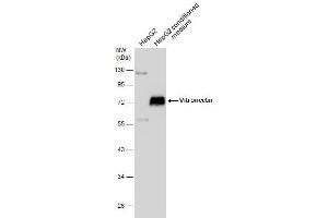 WB Image HepG2 whole cell extract and conditioned medium (30 μg) were separated by 10% SDS-PAGE, and the membrane was blotted with Vitronectin antibody , diluted at 1:1000. (Vitronectin antibody)