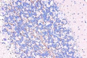 Immunohistochemistry of paraffin-embedded human brain using ARMET/ARP/MANF Rabbit pAb (ABIN6129561, ABIN6143461, ABIN6143463 and ABIN6222775) at dilution of 1:50 (40x lens).
