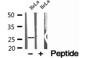 Western blot analysis of extracts of HeLa cells, using NUDT21 antibody. (NUDT21 antibody  (Internal Region))