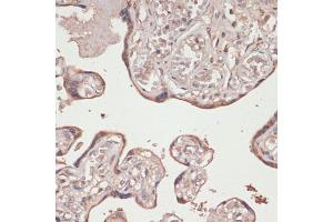 Immunohistochemistry of paraffin-embedded human placenta using Thioredoxin reductase 1 (Thioredoxin reductase 1 (TXNRD1 ) ) antibody (ABIN7270806) at dilution of 1:100 (40x lens). (TXNRD1 antibody)