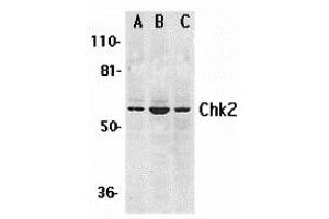 Western Blotting (WB) image for anti-Checkpoint Kinase 2 (CHEK2) (N-Term) antibody (ABIN1031318) (CHEK2 antibody  (N-Term))