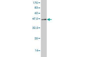 Western Blot detection against Immunogen (44. (CABP4 antibody  (AA 1-170))