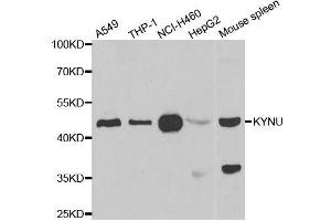 Western blot analysis of extracts of various cell lines, using KYNU antibody. (KYNU antibody  (AA 1-307))