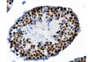 IHC analysis of PTBP2 using anti-PTBP2 antibody (ABIN7599453). (PTBP2 antibody  (AA 1-504))