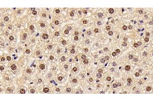 Immunohistochemistry (IHC) image for anti-High Mobility Group Box 1 (HMGB1) (AA 1-215) antibody (ABIN7431743)