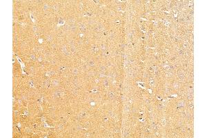 ABIN7094805 and ABIN7098856 at 1/100 staining Rat brain tissue by IHC-P. (MCT3 antibody  (C-Term))