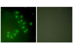 Immunofluorescence analysis of A549 cells, using p63 antibody (ABIN5976481). (TCP1 alpha/CCTA antibody  (C-Term))
